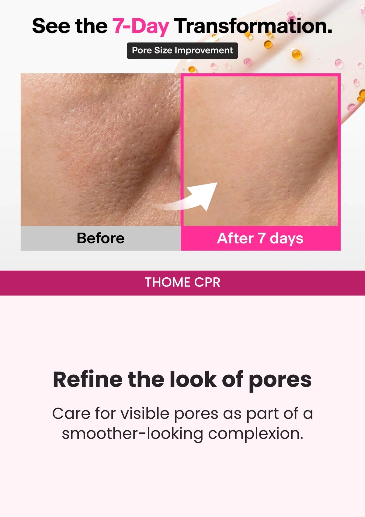THOME CPR — Seven-day pore-size transformation